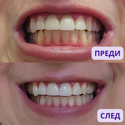 The Magic Powder - PAP+ Whitening Booster