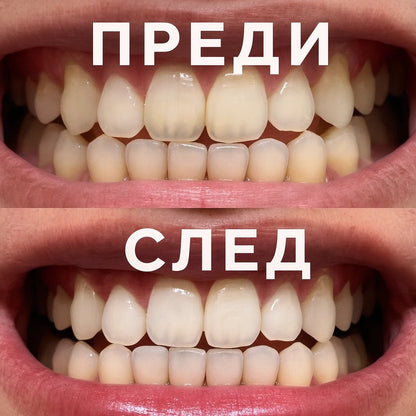WhiteMe - V34 (серум за избелване)